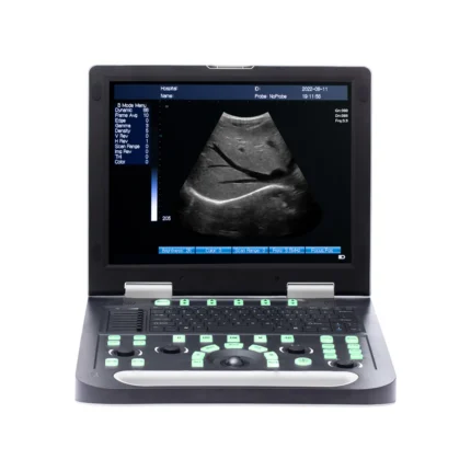 N50 NoteBook Ultrasound Machine