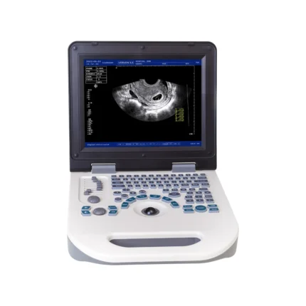 XF Nyro10 Ultrasound Machine