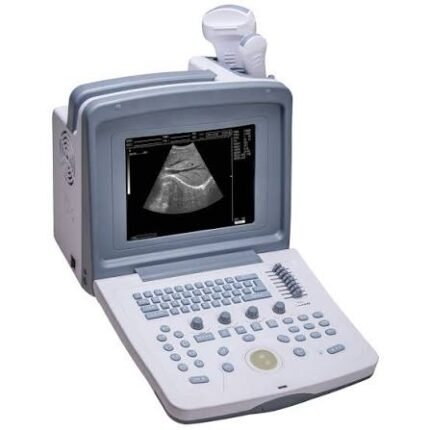 WED-9618 Ultrasound Machine